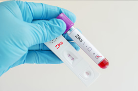 Protocolos de vigilancia epidemiol&oacute;gica